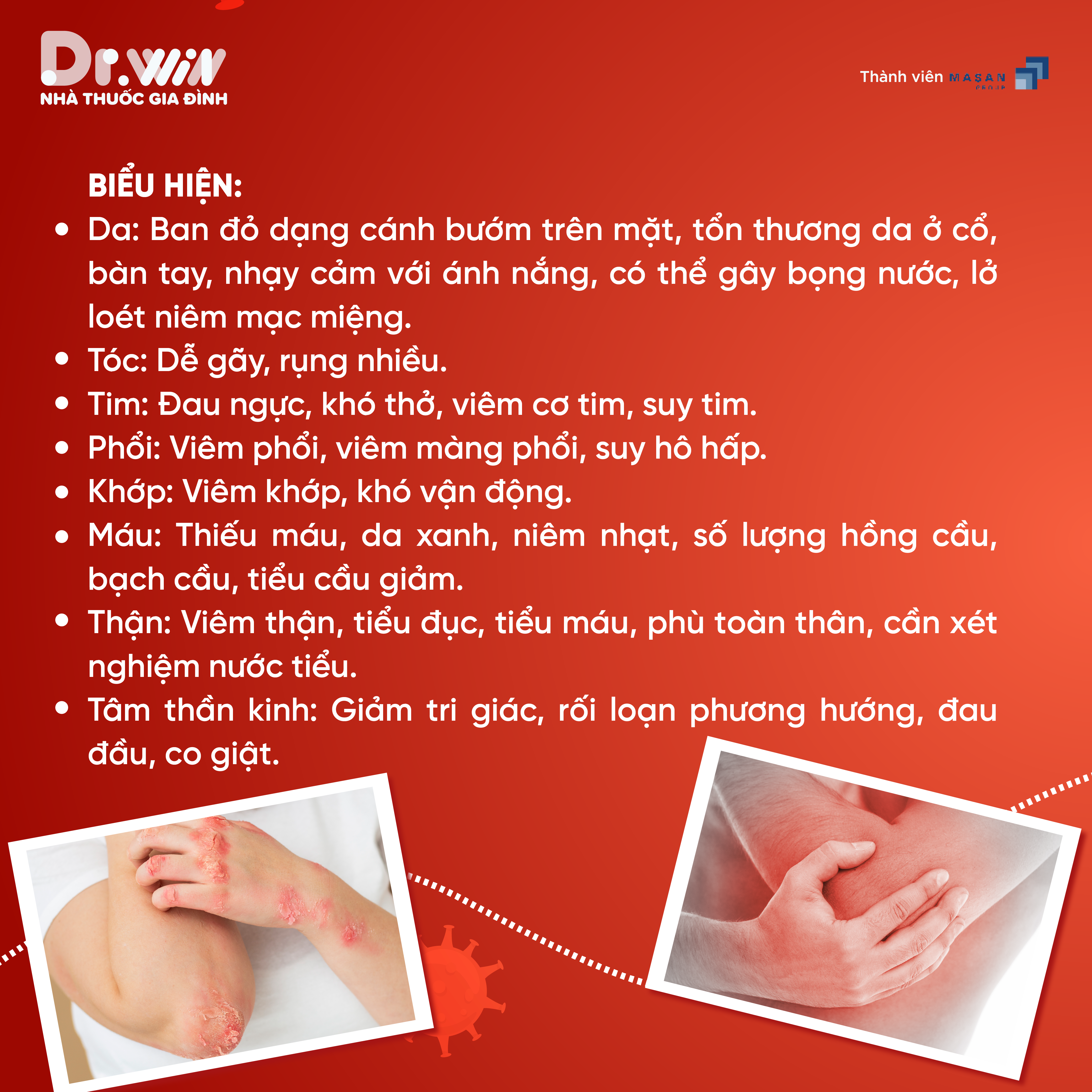 TẤT TẦN TẬT NHỮNG ĐIỀU BẠN NÊN BIẾT VỀ BỆNH LUPUS BAN ĐỎ - 2