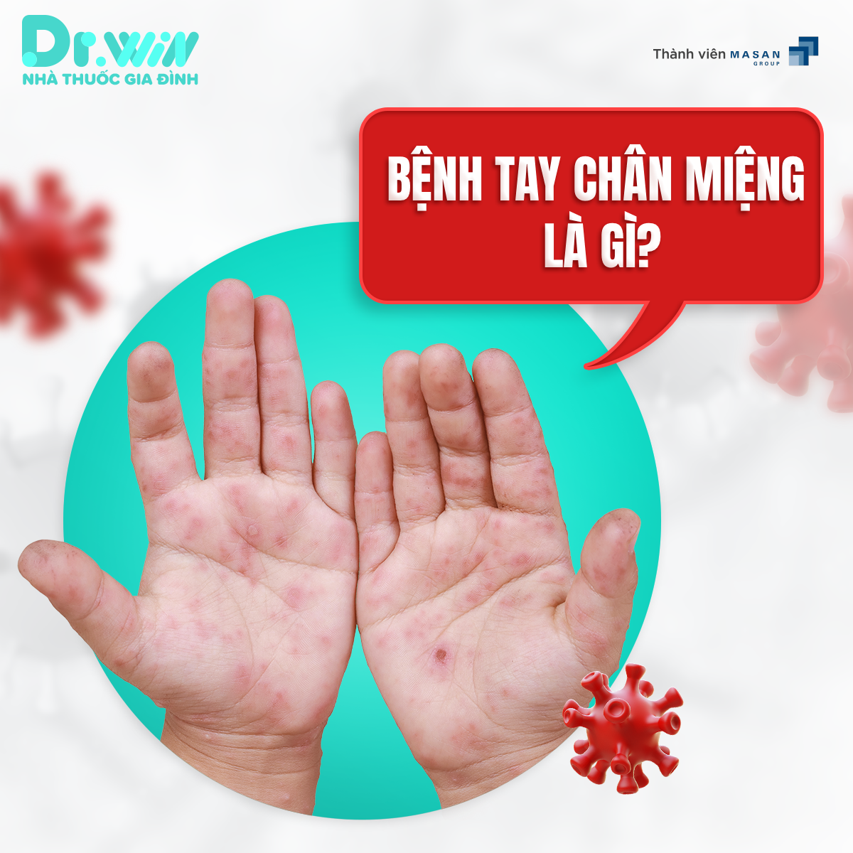 NHỮNG ĐIỀU CẦN BIẾT VỀ BỆNH TAY CHÂN MIỆNG 1