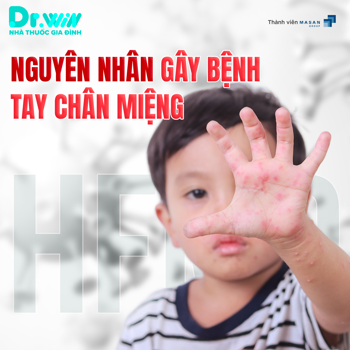 NHỮNG ĐIỀU CẦN BIẾT VỀ BỆNH TAY CHÂN MIỆNG 2