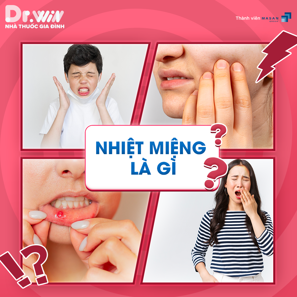 NHIỆT MIỆNG 1