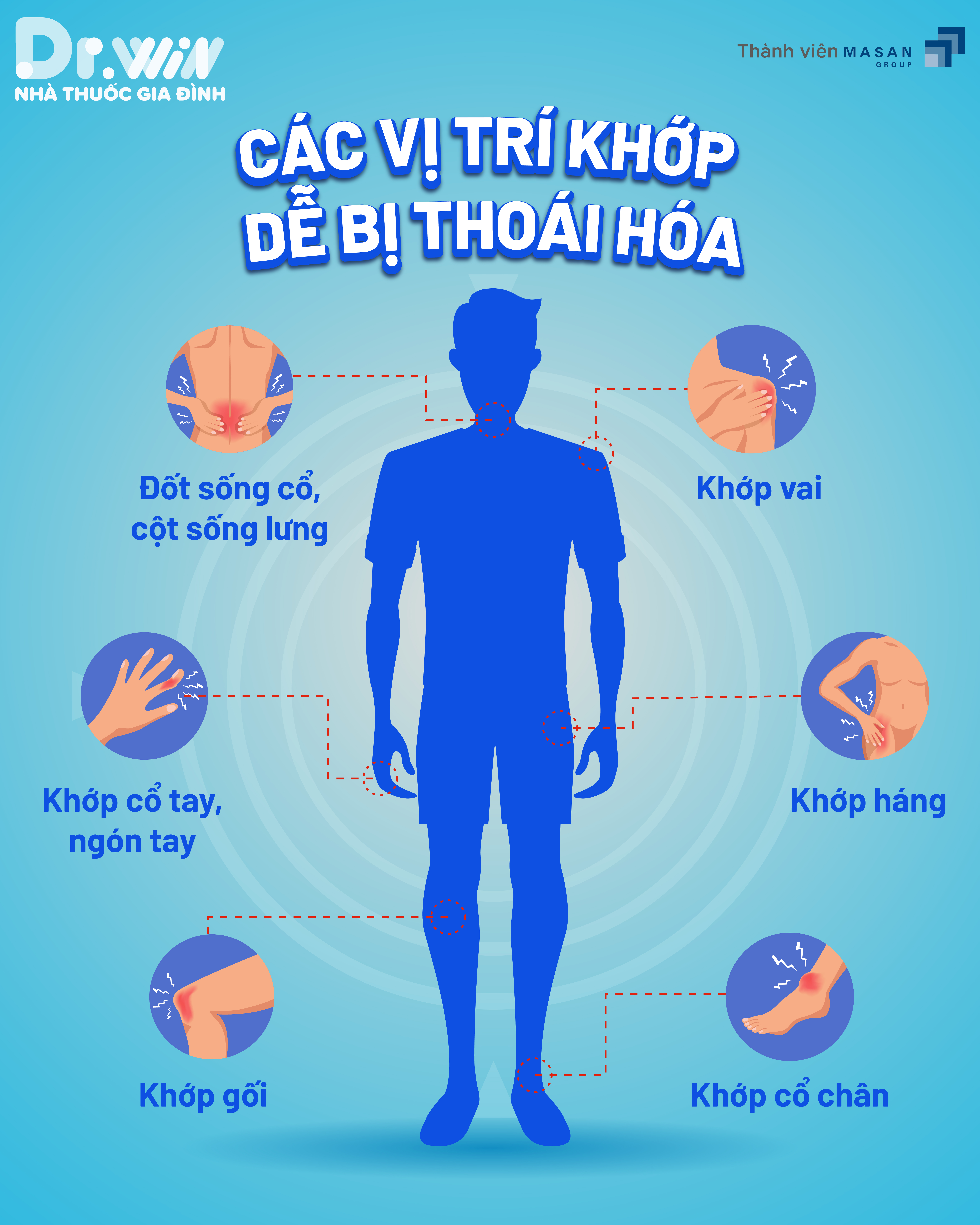 THOÁI HOÁ KHỚP VÀ NHỮNG ĐIỀU CẦN BIẾT 1